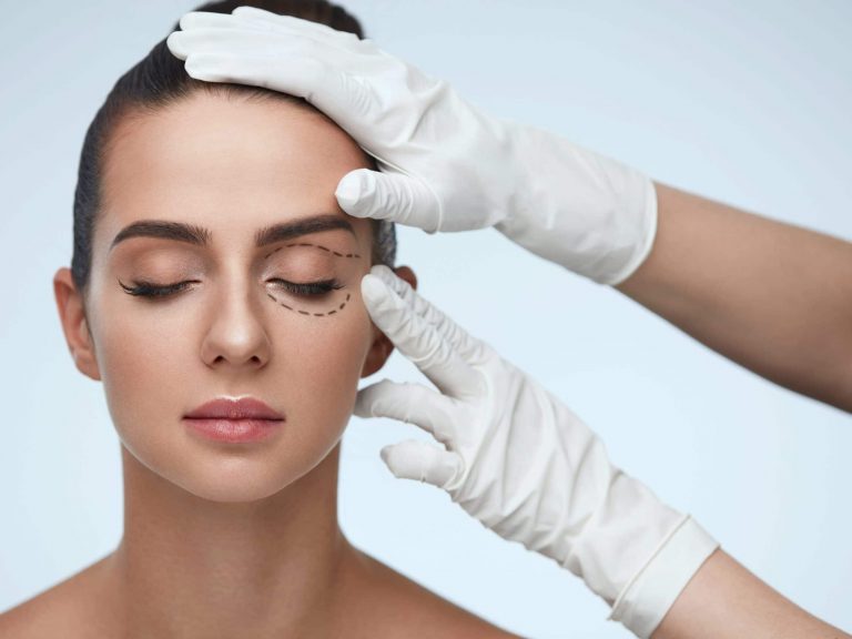 Blepharoplasty | Cache Valley Facial Plastics Providence, UT