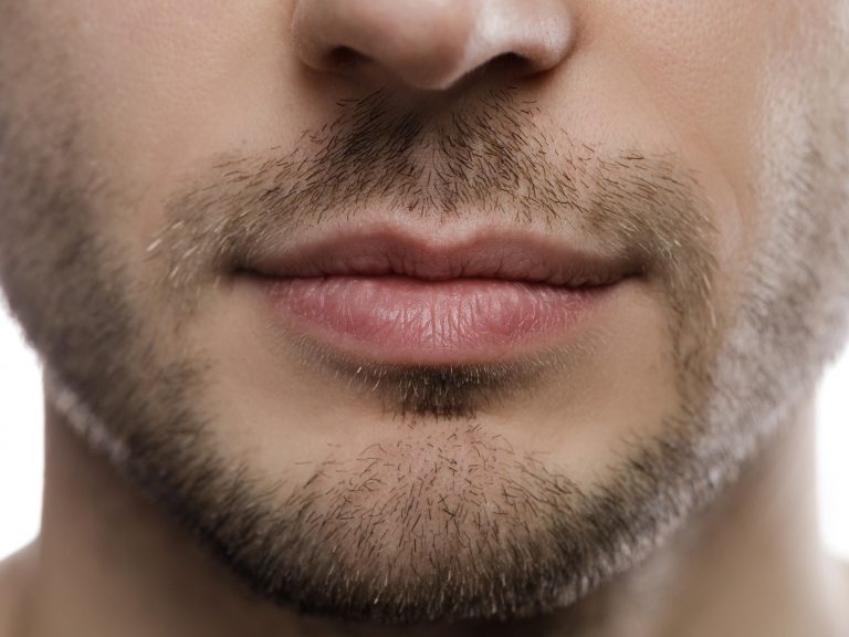 Does Genioplasty Improve Jawline? Cache Valley Facial Plastic| Providence, UT
