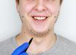 What Is The Purpose Of Genioplasty | Cache Valley Facial Plastics | Logan, UT