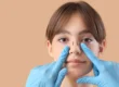 A woman with markings for reconstructive surgery on her nose in Providence UT