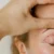 Women receiving Blepharoplasty Treatment In Providence, UT