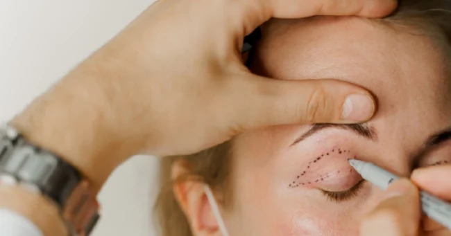 Women receiving Blepharoplasty Treatment In Providence, UT