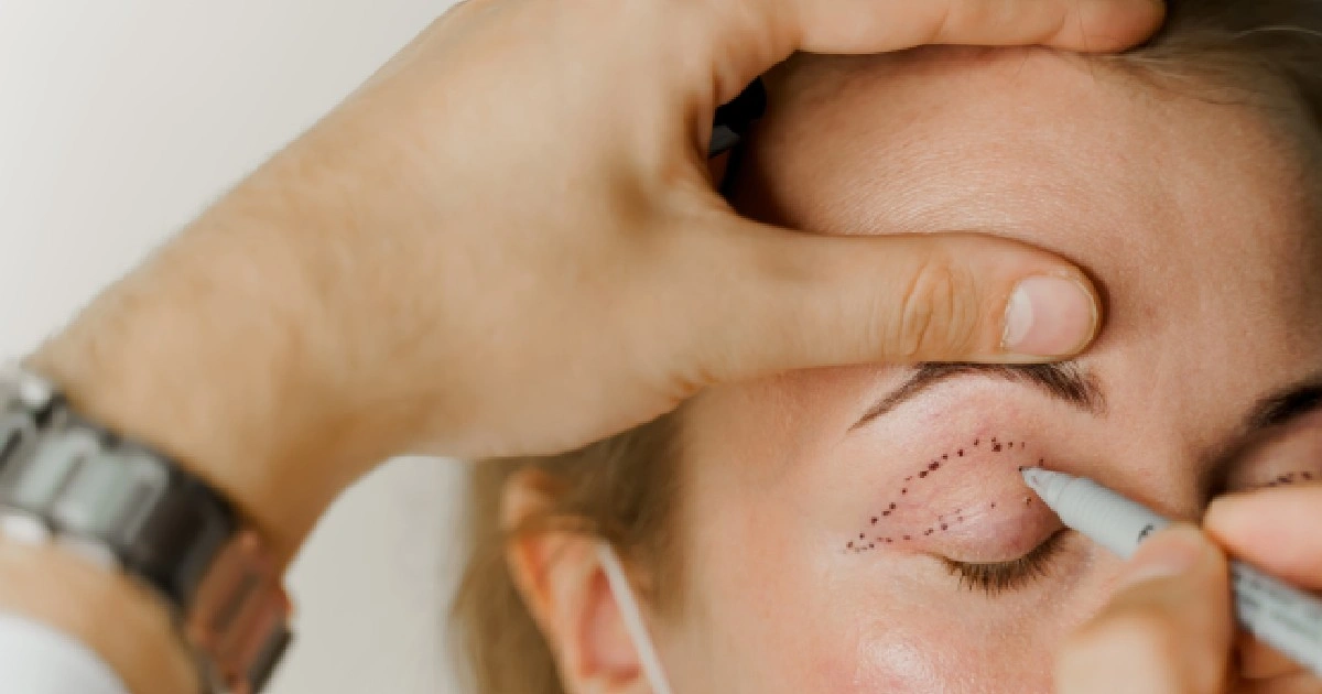 Women receiving Blepharoplasty Treatment In Providence, UT